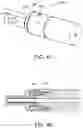 Fig. 05 - Endoscope with integrated attachment mechanisms and methods of use