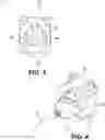 Fig. 04 - Medical device assembly and related methods