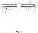 Fig. 03 - GASTRIC CALIBRATION HOSE
