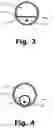 Fig. 04 - GASTRIC CALIBRATION HOSE
