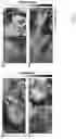 Fig. 05 - SYSTEM AND METHOD FOR INTRAOPERATIVE, NON-INVASIVE NERVE IDENTIFICATION USING SNAPSHOT POLARIMETRY