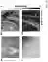 Fig. 06 - SYSTEM AND METHOD FOR INTRAOPERATIVE, NON-INVASIVE NERVE IDENTIFICATION USING SNAPSHOT POLARIMETRY
