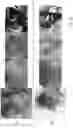 Fig. 07 - SYSTEM AND METHOD FOR INTRAOPERATIVE, NON-INVASIVE NERVE IDENTIFICATION USING SNAPSHOT POLARIMETRY