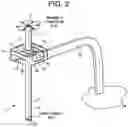 Fig. 03 - PROXIMAL-END SECUREMENT OF A MINIMALLY INVASIVE WORKING CHANNEL