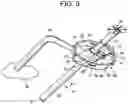 Fig. 04 - PROXIMAL-END SECUREMENT OF A MINIMALLY INVASIVE WORKING CHANNEL