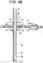 Fig. 06 - PROXIMAL-END SECUREMENT OF A MINIMALLY INVASIVE WORKING CHANNEL