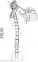 Fig. 10 - PROXIMAL-END SECUREMENT OF A MINIMALLY INVASIVE WORKING CHANNEL