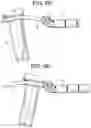 Fig. 11 - PROXIMAL-END SECUREMENT OF A MINIMALLY INVASIVE WORKING CHANNEL
