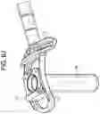 Fig. 15 - PROXIMAL-END SECUREMENT OF A MINIMALLY INVASIVE WORKING CHANNEL