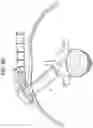Fig. 19 - PROXIMAL-END SECUREMENT OF A MINIMALLY INVASIVE WORKING CHANNEL