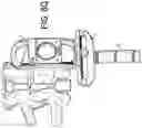Fig. 21 - PROXIMAL-END SECUREMENT OF A MINIMALLY INVASIVE WORKING CHANNEL