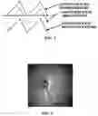 Fig. 03 - Method for calculating fundus oculi target motion amount of line scan imaging system