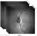 Fig. 05 - Method for calculating fundus oculi target motion amount of line scan imaging system