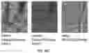 Fig. 35 - System, method and apparatus for retinal absorption phase and dark field imaging with oblique illumination