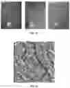 Fig. 41 - System, method and apparatus for retinal absorption phase and dark field imaging with oblique illumination