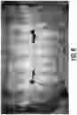 Fig. 06 - Trans-illuminative intraoral diagnostic lighting system and method of using
