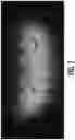 Fig. 07 - Trans-illuminative intraoral diagnostic lighting system and method of using