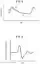 Fig. 08 - ELECTRONIC DEVICE, METHOD FOR CONTROLLING ELECTRONIC DEVICE, AND PROGRAM FOR CONTROLLING ELECTRONIC DEVICE
