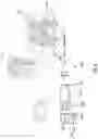 Fig. 04 - MULTIPARAMETER LEAD SET AND METHODS OF USE THEREOF