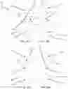 Fig. 15 - MULTIPARAMETER LEAD SET AND METHODS OF USE THEREOF