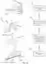 Fig. 42 - MULTIPARAMETER LEAD SET AND METHODS OF USE THEREOF