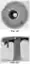 Fig. 13 - NONINVASIVE MEDICAL DIAGNOSTICS USING ELECTRICAL IMPEDANCE METRICS AND CLINICAL PREDICTORS