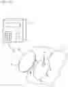 Fig. 11 - Analyte monitoring device and methods of use