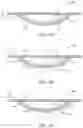 Fig. 04 - METHODS AND APPARATUS FOR ELECTRODE PLACEMENT AND TRACKING