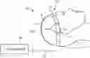 Fig. 01 - METHODS AND APPARATUS FOR ELECTRODE PLACEMENT AND TRACKING