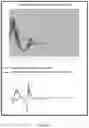 Fig. 03 - COMMON MODE REJECTION CONFIGURATION FOR IMPROVING SPATIAL RESOLUTION