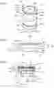 Fig. 02 - Intracalvarial BCI systems and methods for their making, implantation and use