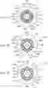 Fig. 11 - Intracalvarial BCI systems and methods for their making, implantation and use