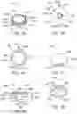 Fig. 20 - Intracalvarial BCI systems and methods for their making, implantation and use