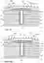 Fig. 22 - Intracalvarial BCI systems and methods for their making, implantation and use