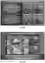 Fig. 14 - OPTOACOUSTIC FEATURE SCORE CORRELATION TO IPSILATERAL AXILLARY LYMPH NODE STATUS