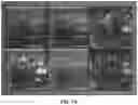 Fig. 20 - OPTOACOUSTIC FEATURE SCORE CORRELATION TO IPSILATERAL AXILLARY LYMPH NODE STATUS