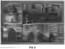 Fig. 23 - OPTOACOUSTIC FEATURE SCORE CORRELATION TO IPSILATERAL AXILLARY LYMPH NODE STATUS
