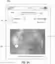 Fig. 10 - WOUND MEASUREMENT