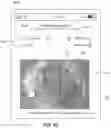 Fig. 12 - WOUND MEASUREMENT