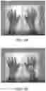 Fig. 03 - Automatic exposure control method for X-ray imaging, storage medium and medical device