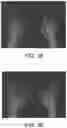 Fig. 04 - Automatic exposure control method for X-ray imaging, storage medium and medical device