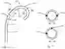 Fig. 05 - MEDICAL TOOL POSITIONING DEVICES, SYSTEMS, AND METHODS OF USE AND MANUFACTURE