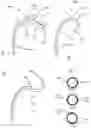 Fig. 07 - MEDICAL TOOL POSITIONING DEVICES, SYSTEMS, AND METHODS OF USE AND MANUFACTURE