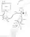Fig. 01 - Ultrasound imaging system for generation of a three-dimensional ultrasound image