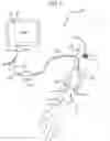 Fig. 02 - Ultrasound imaging system for generation of a three-dimensional ultrasound image