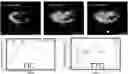 Fig. 01 - Quantification of Dynamic Contrast Enhanced Imaging using Second Order Statistics and Perfusion Modeling