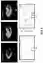 Fig. 03 - Quantification of Dynamic Contrast Enhanced Imaging using Second Order Statistics and Perfusion Modeling
