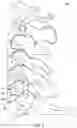 Fig. 03 - Cervical retractor and method