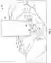 Fig. 10 - Cervical retractor and method