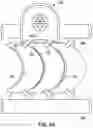 Fig. 11 - Cervical retractor and method